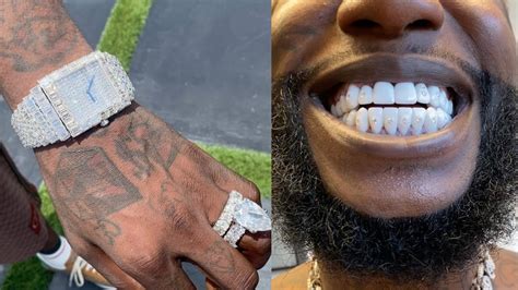 Gucci Mane Spends 0k To Drill VVS Diamonds In His Teeth 